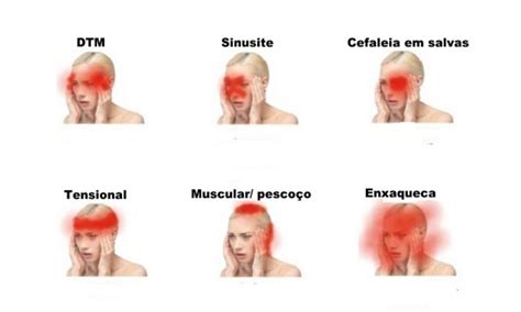 sinais de que a dor de cabeça pode ser perigosa e deve procurar um médico com urgência
