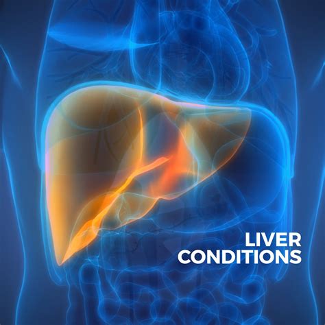 General Liver Conditions Gastro Md