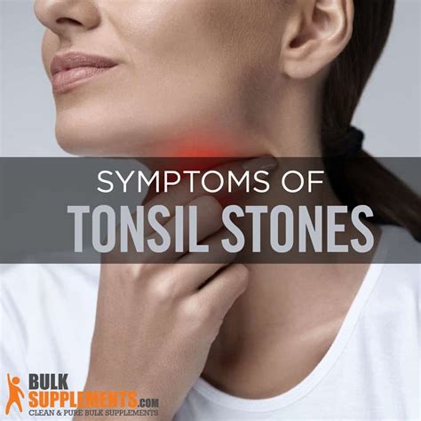 Tonsilloliths Tonsil Stones Risk Factors Symptoms And Treatment