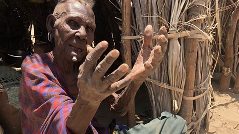 Bbc World Service Focus On Africa Kenyan Anger Over Turkana Starvation Being Ignored