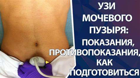 Дивертикул операция диета УЗИ мочевого пузыря: как подготовиться к УЗИ мочевого пузыря, показания УЗИ мочевого пузыря: как подготовиться к УЗИ мочевого пузыря, показания Дивертикул операция диета