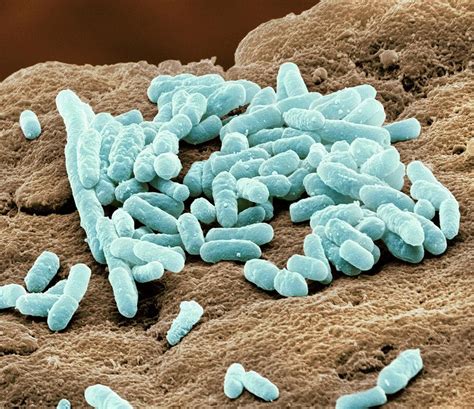 Lactobacillus Bacteria Photograph By Steve Gschmeissner Pixels