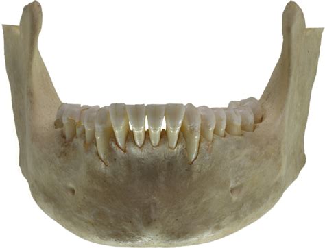 (3) at the lower end of. Jaw - wikidoc