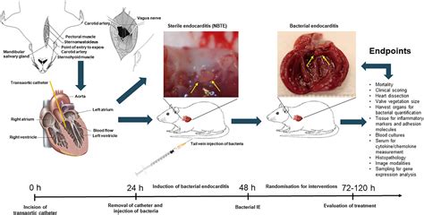Frontiers Anti Biofilm Approach In Infective Endocarditis Exposes New