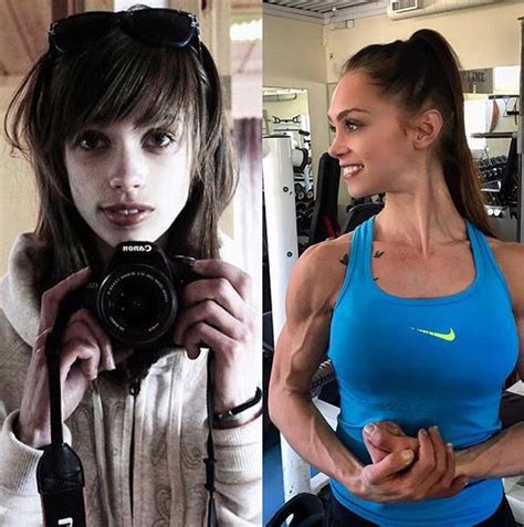Suicidal Anorexia Sufferer Who Weighed Less Than Six Stone Defeats