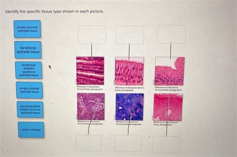 Solved Identify The Specific Tissue Type Shown In Each