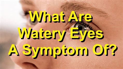 What Are Watery Eyes A Symptom Of Youtube