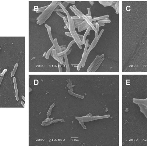 Scanning Electron Micrographs Of Wild Type Mc Strain And M