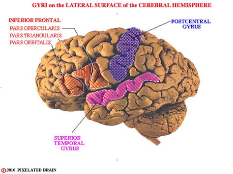 Lateral View Of The Lateral Cerebral Surface Showing The Sulci And Gyri