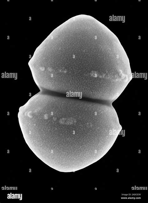 Scanning Electron Micrograph Sem Of Enterococcus Faecium Also Known