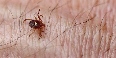 The Tick That Can Make You Allergic To Meat Knowledgenuts