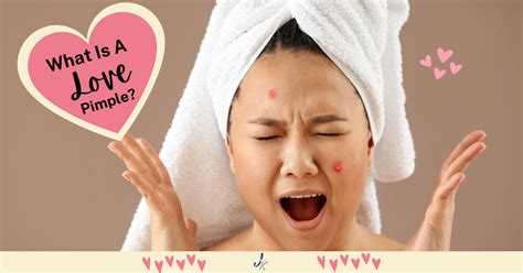 Love Pimples What They Are And How To Treat Them Jean Kelly Acne