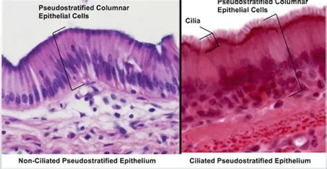 Difference Between Pseudostratified And Transitional Epithelium