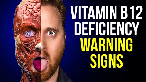 10 vitamin b12 deficiency symptoms to never ignore youtube