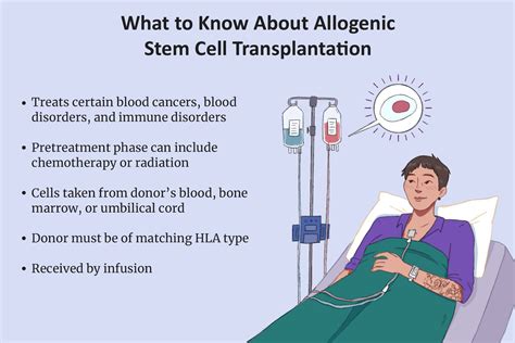 Allogeneic Stem Cell Transplantation Procedure