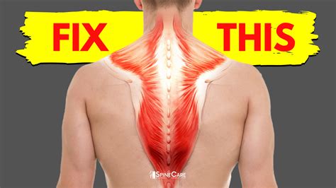 How To Fix A Tight Upper Back In 30 Seconds Spinecare