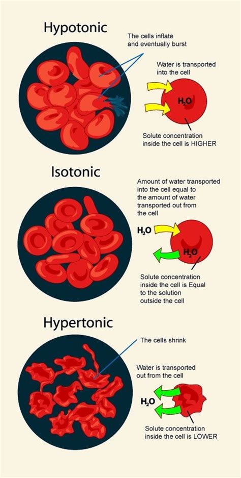 Medical And Health Science Hypotonic Isotonic Hypertonic Solution