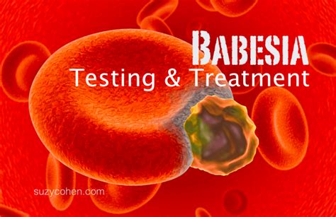 Babesia Testing And Treatment Suzy Cohen Suggests Ways To Heal