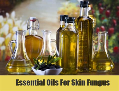 7 Skin Fungus Home Remedies Natural Treatments And Cures Herbal
