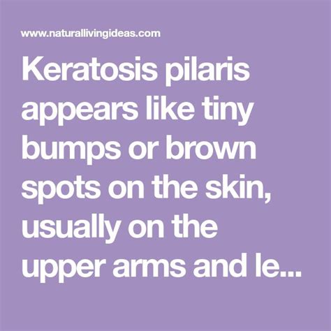 11 Ways To Get Rid Of Keratosis Pilaris For Good Keratosis Pilaris