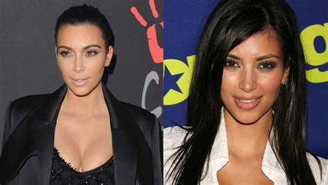 The Kardashians Before And After Plastic Surgery