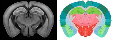 Mouse Brain Mapped In 3d At Single Cell Resolution American Biotech News