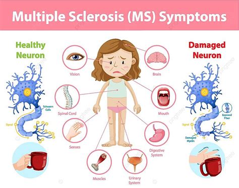 Multiple Sclerosis Ms Symptoms Information Infographic Signage Signs