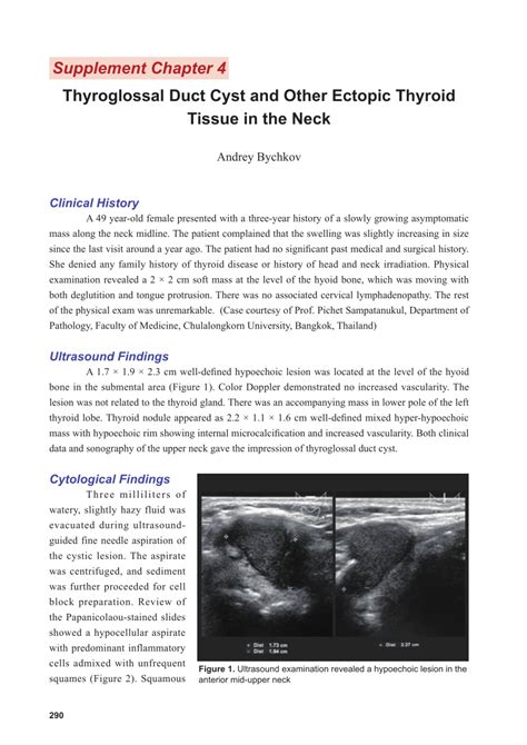 Pdf Thyroglossal Duct Cyst And Other Ectopic Thyroid Tissues In The Neck My Xxx Hot Girl