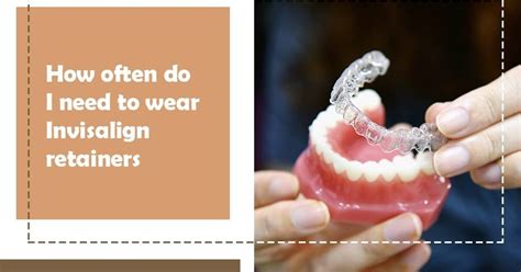 How Long Do I Have To Wear Invisalign Retainer World Informs
