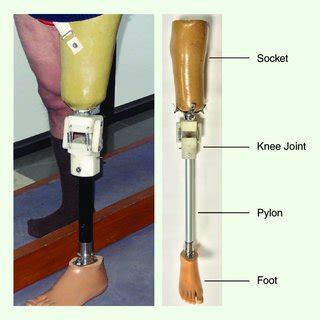 Fig The Various Parts Of A Lower Limb Prosthesis Download Scientific Diagram