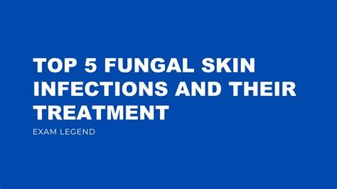 Top 5 Fungal Skin Infections And Their Treatment Exam Legend Free