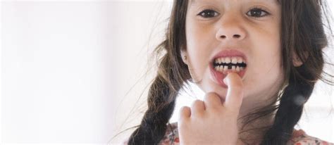 What Causes Crooked Teeth In Children Tindale Dental Penrith Dentist