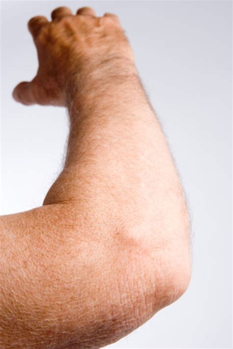 Causes Of Painful Dry Skin On The Elbows