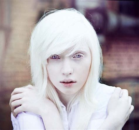 The Most Beautiful Albino Girl In World Bukge Albino Girl Albino