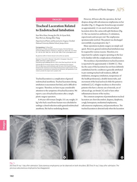 Pdf Tracheal Laceration Related To Endotracheal Intubation
