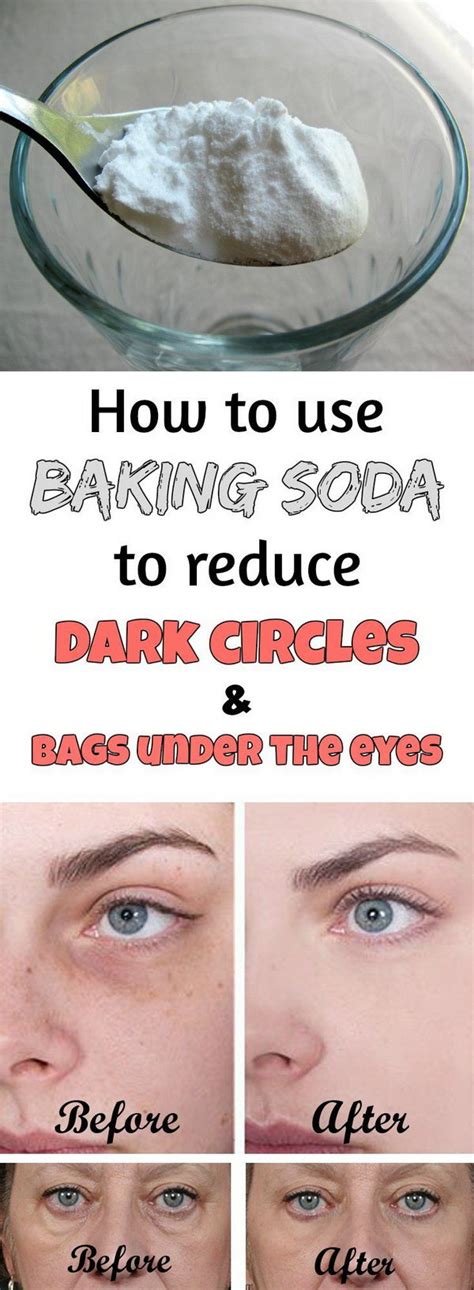 Ways To Get Rid Of Dark Circles Under Your Eyes Hative