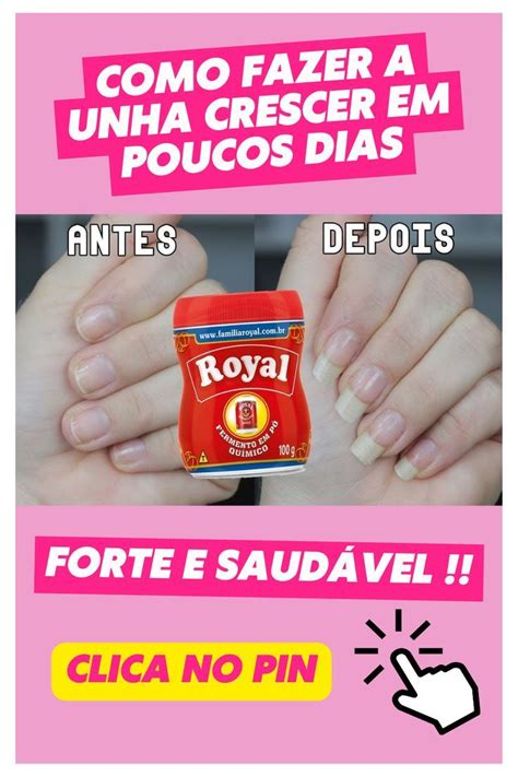 Como Fazer A Unha Crescer Em Poucos Dias Forte E Saud Vel Receita