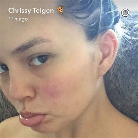 Chrissy Teigen Posted A No Makeup Selfie To Show What Really Happens To Your Skin Postpregnancy