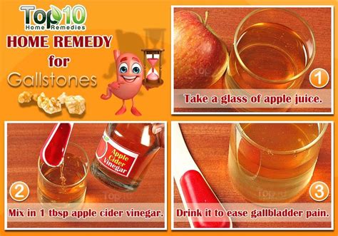 Home Remedies For Gallstones Top 10 Home Remedies