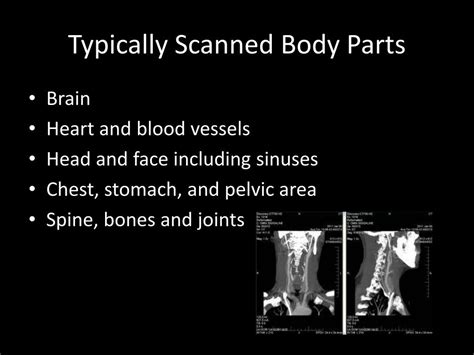 photocopied body parts