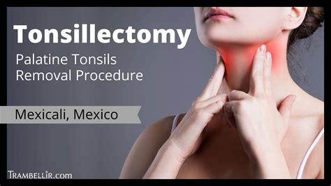 Tonsillectomy Palatine Tonsils Removal Procedure Trambellir