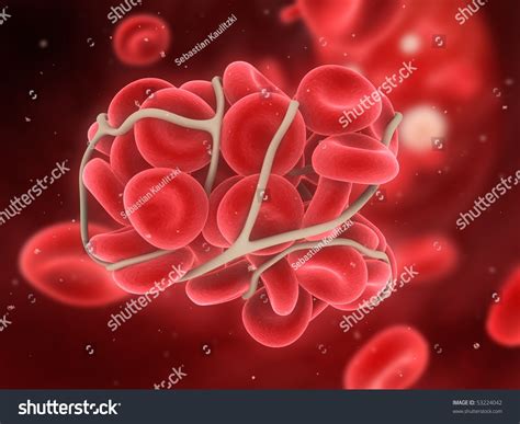 15091 Blood Clot Images Stock Photos And Vectors Shutterstock