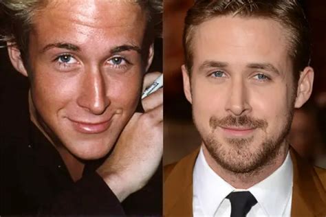 Ryan Gosling Plastic Surgery Before And After Celebie