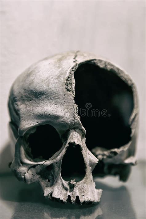 Broken Human Skull Close Up Toned Image Royalty Free Stock