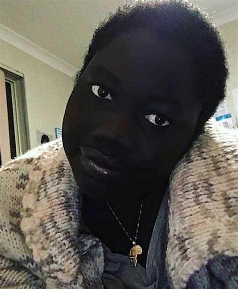 Photos South Sudanese Student Mocked Got Her Incredibly Dark Skin Tone