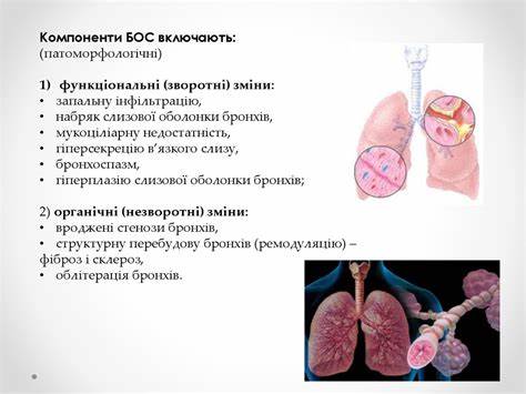 Диета при бронхообструктивном синдроме Бронхообструктивний синдром - презентация онлайн Бронхообструктивний синдром - презентация онлайн Диета при бронхообструктивном синдроме