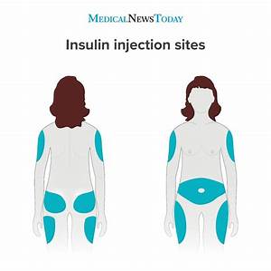 Diagram Of Injection Sites