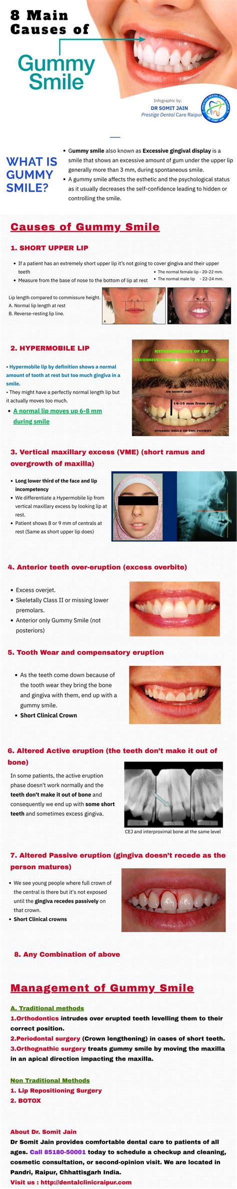 Gummy Smile Excessive Gingival Display Meaningcausestreatment