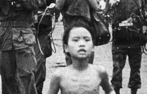 Napalm Girl Years Later Receives Final Treatment