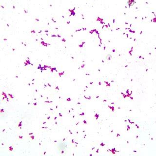 V. fluvialis microscopic appearance using Gram stain. | Download ...